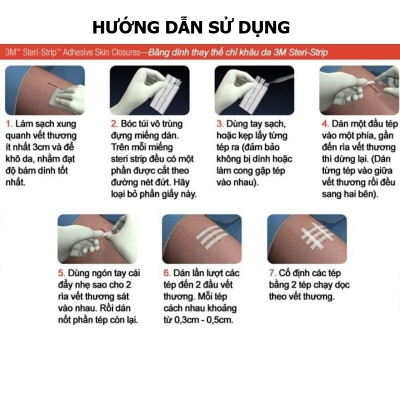 Set 3 vỉ 30 miếng dán thay chỉ khâu da 3M Steri-strip™ R1546 – Size 6mm x 100mm | Sản xuất tại Mỹ