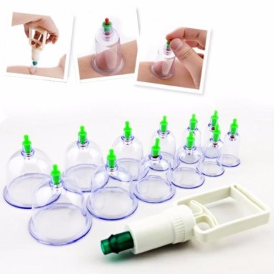 Bộ giác hơi 12 món không dùng lửa (cao cấp) Giúp giảm các chứng đau lưng; đau đầu; cảm cúm; nhức mỏi