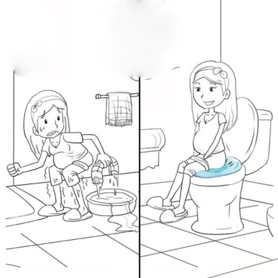 Chậu nhựa cứng kèm vòi xịt tiện lợi xông vùng kín cho bệnh nhân trĩ/ phụ khoa/ phụ nữ sau sinh CNM03