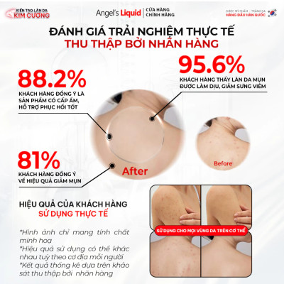 [PHIÊN BẢN NÂNG CẤP] Xịt Giảm Mụn Lưng Sáng Da Cơ Thể Angel