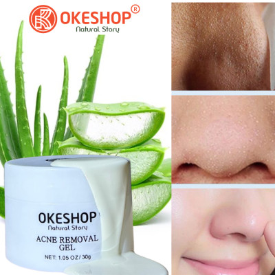 Gel Lột Mụn OKESHOP 30ml - Giải Pháp Loại Bỏ Mụn Đầu Đen - Mụn Cám - Bạ Nhờn - Làm Sạch Sâu Và Thu Nhỏ Lỗ Chân Lông
