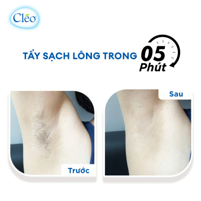 Kem Tẩy Lông Chiết Xuất Bơ Cleo Dành Cho Da Nhạy Cảm 25g, an toàn, không đau và đạt hiệu quả nhanh chóng