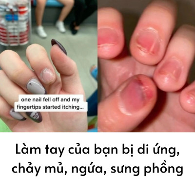 Set 20 Miếng Dán Móng Tay Silicon Nghệ Thuật Nhập Khẩu Hàn Quốc Bellaeve