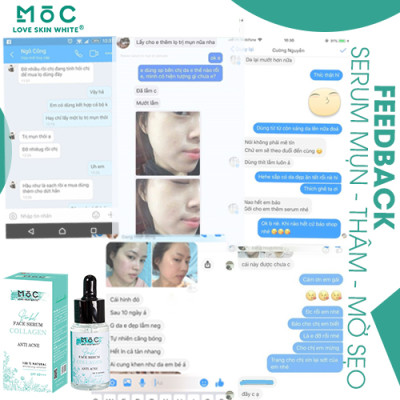 SERUM NGỪA MỤN THÂM - MỜ SẸO 25ML - MOC