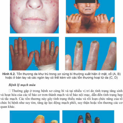 Sách - Bệnh học Nội khoa 2025 (Trọn bộ)